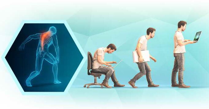 ordenagailuan lan egitean jarrera txarra eta osteokondrosi torazikoa