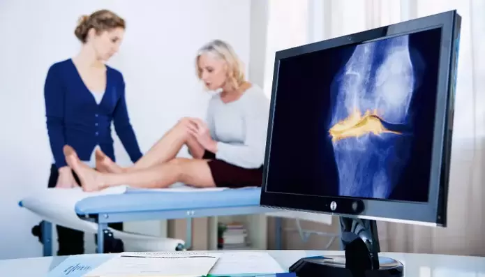 Emakume baten artikulazioaren artrosia