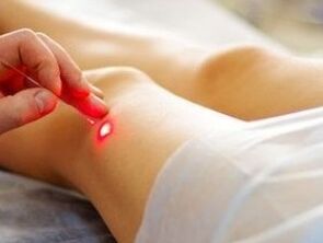 Belauneko artikulazioaren artrosiaren tratamendua laser batekin